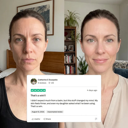 L’effet d’un soin professionnel, chez vous — sans injections